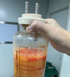 武汉水动力吸脂手术要做多久？
